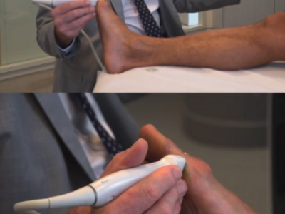 Ultrasound of the Foot