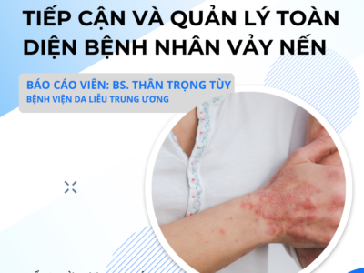 Tiếp cận và quản lý toàn diện bệnh nhân vảy nến